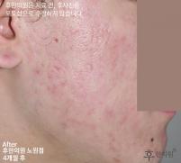 전후사진