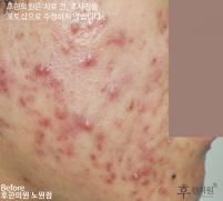 전후사진