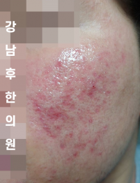 전후사진