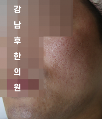 전후사진