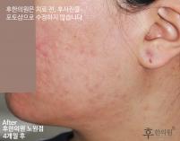 전후사진