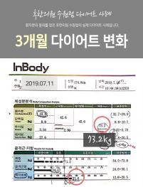 치료 전