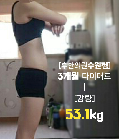 치료 후