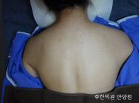 치료 전