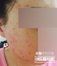 전후사진