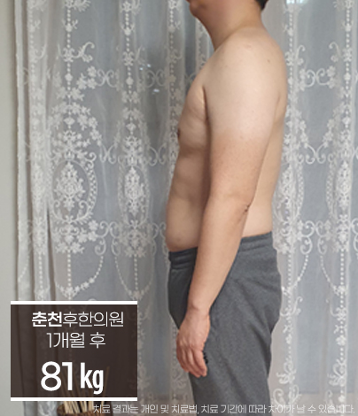 치료 후