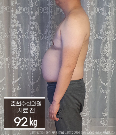 치료 전