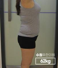 전후사진