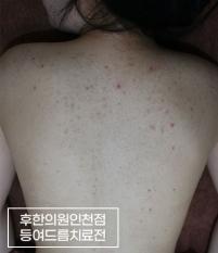 전후사진
