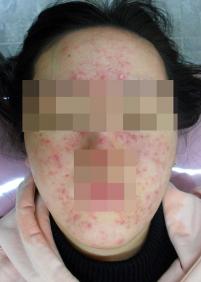 전후사진
