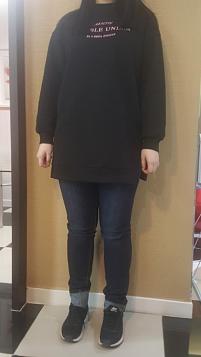 전후사진