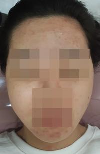 전후사진