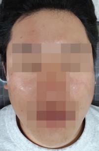 전후사진