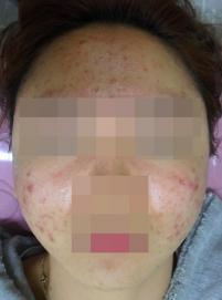 전후사진