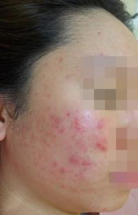 전후사진