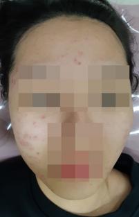 전후사진