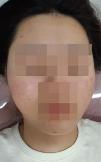 전후사진