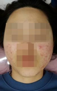 전후사진
