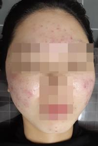 전후사진