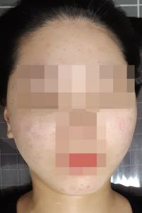 전후사진