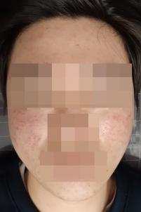 전후사진