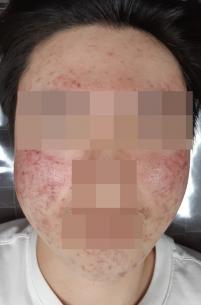 전후사진