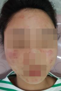 전후사진