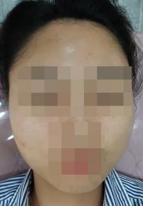 전후사진