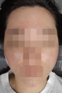 전후사진