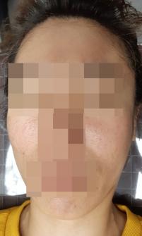 전후사진