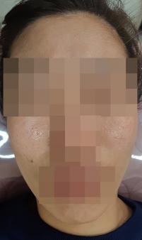 전후사진
