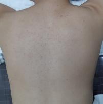 전후사진