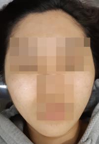 전후사진