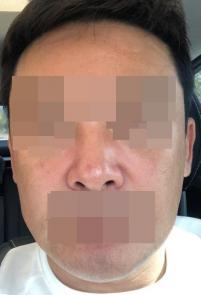 전후사진