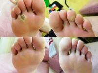 전후사진