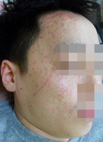 전후사진