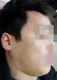 전후사진