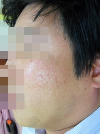 전후사진