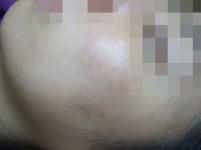 전후사진