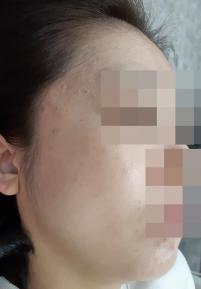 전후사진