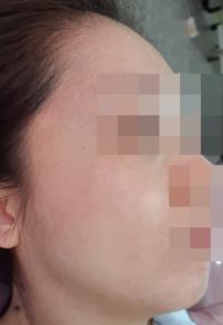 전후사진