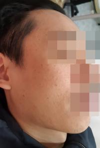 전후사진