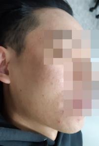 전후사진