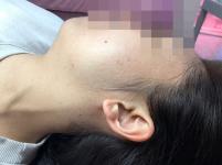 전후사진