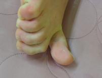 전후사진