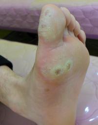 전후사진