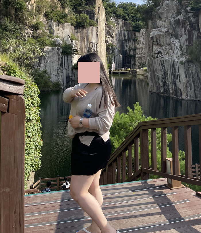 전후사진