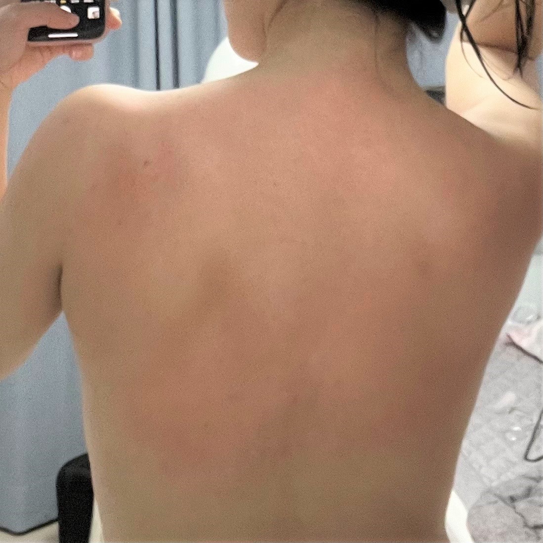 전후사진