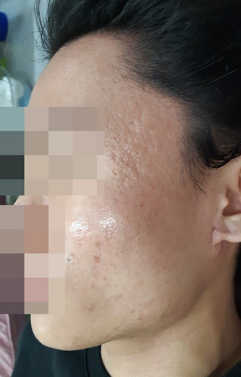 전후사진