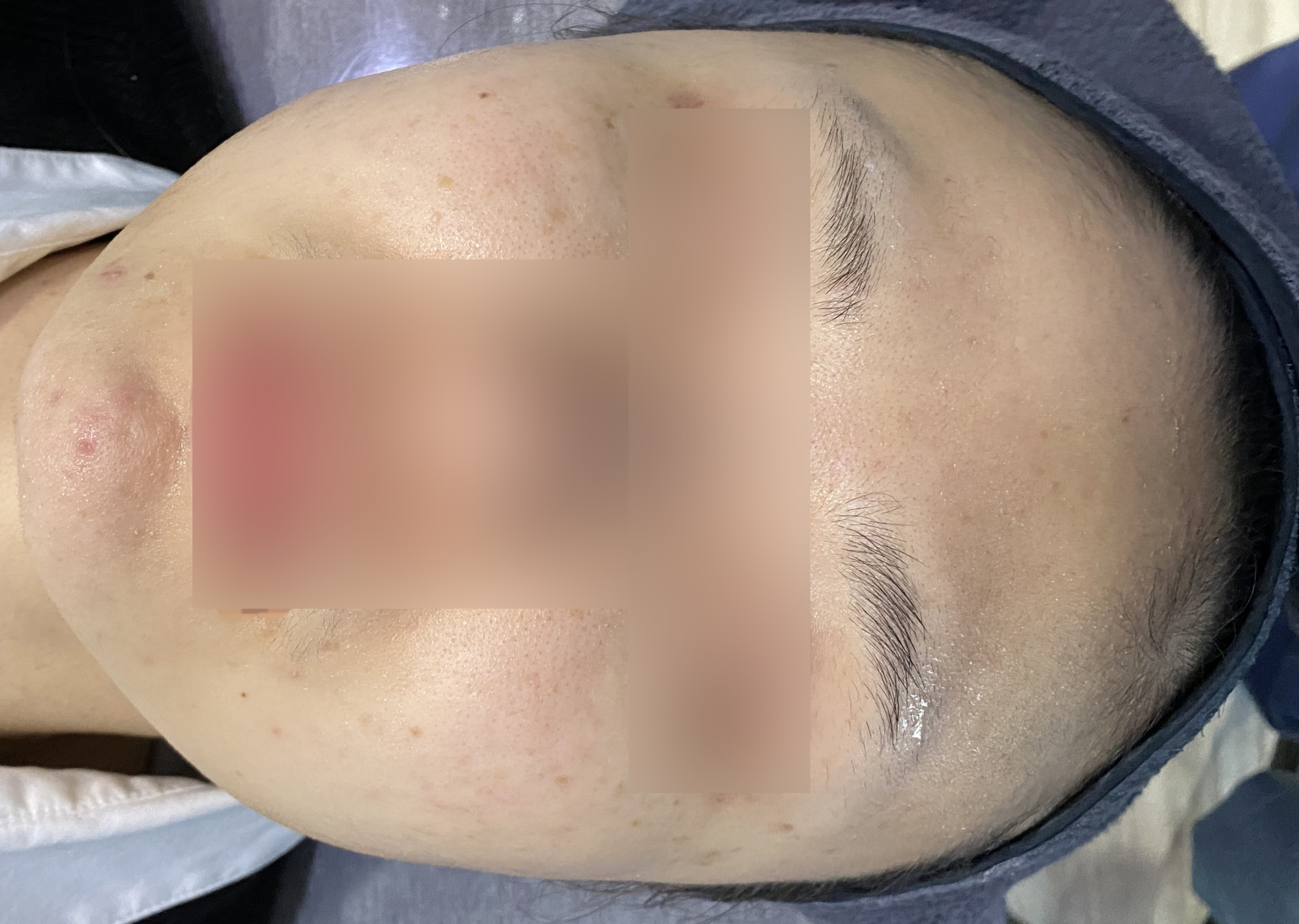 전후사진